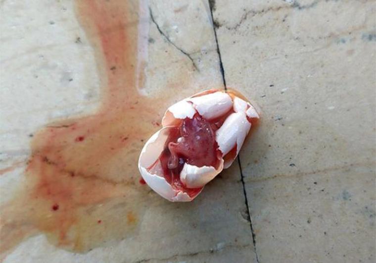 Η αβάσταχτη ελαφρότητα του Δήμου Καλαμάτας